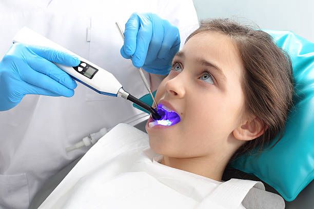 Dental sealants for children